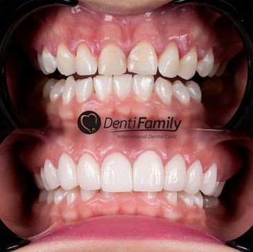 Slider image (6) DENTIFAMILY